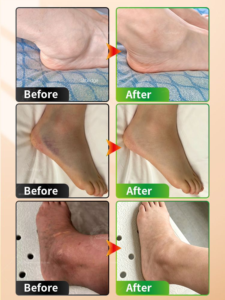 Portable Heated Ankle Massager - огляд і ціна Ankle Brace Support